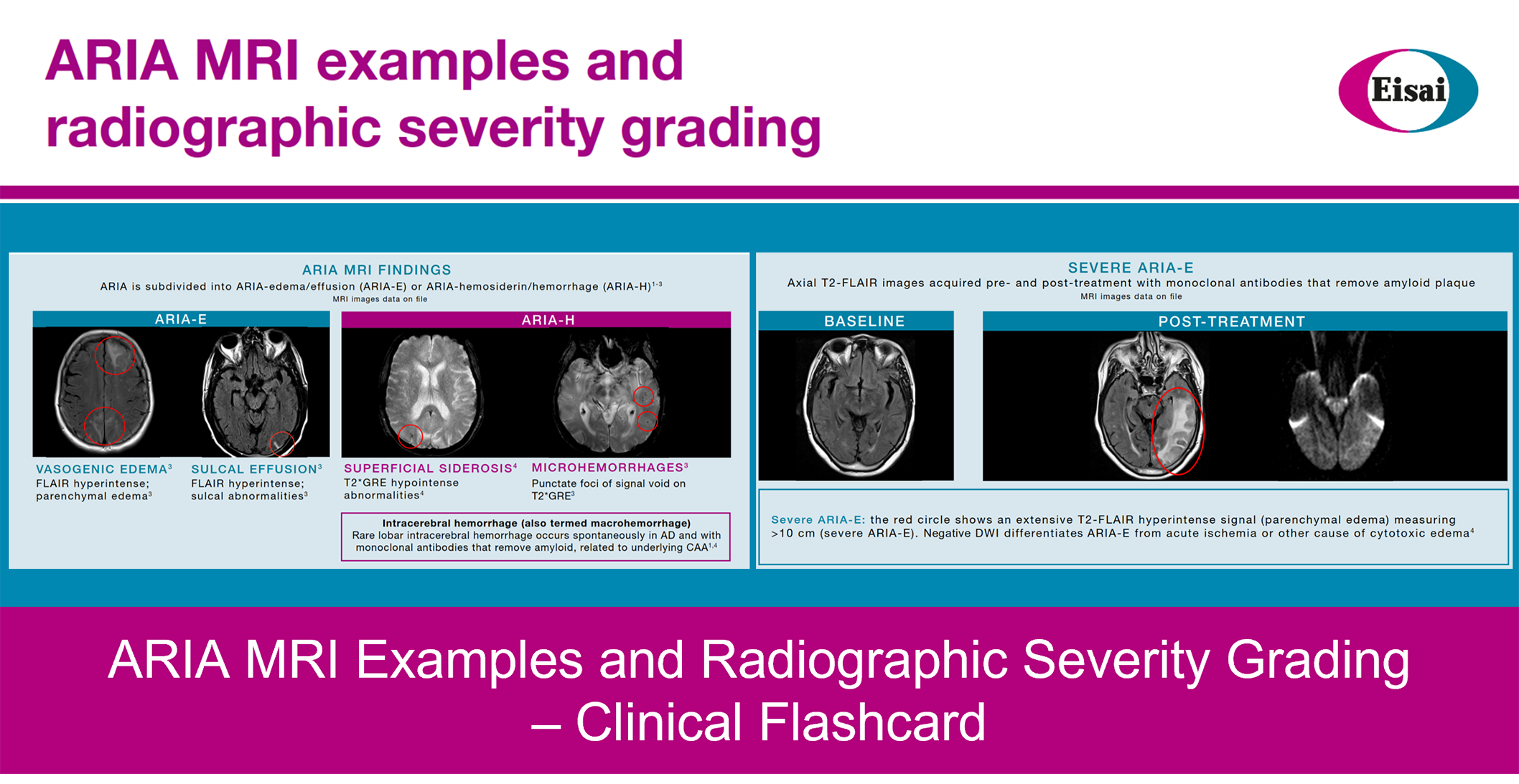 SelfGuided ARIA Educational Materials Understanding ARIA